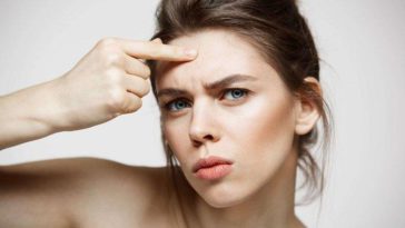 penyebab beruntusan di jidat